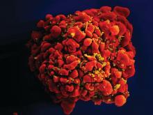 T-cell infected by HIV particles.